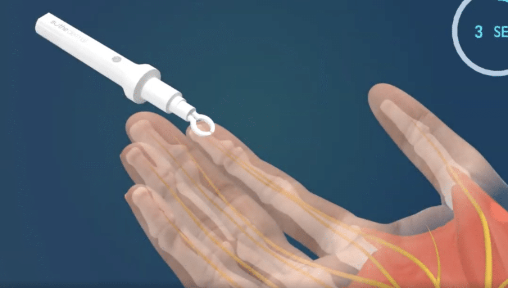 Thumbnail showing DigiVibe pain-gate theory